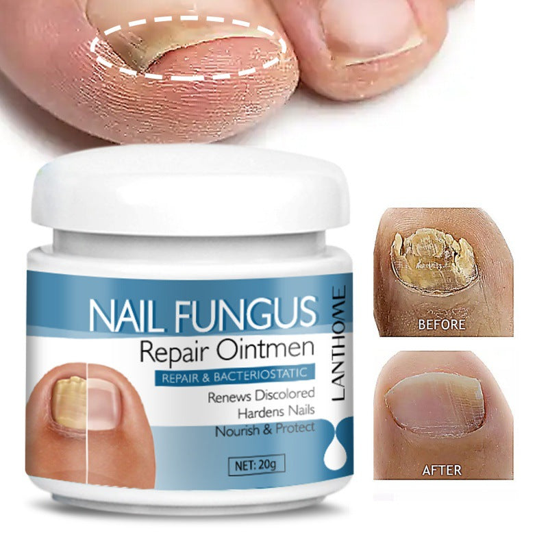 Body Nail Repair Care  20g
