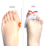 SILICONE BUNION CORRECTOR